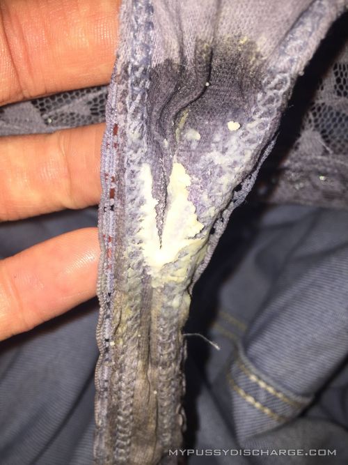 #Creamy vaginal discharge on dirty panties. You can submit your pictures to mydischargepic@gmail.com