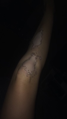 Vitiligo, 8/5/15