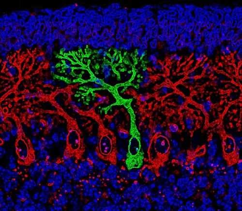 usefulmistakes:ALS-linked gene found switched on in new bits of the brain ALS, also known as Motor