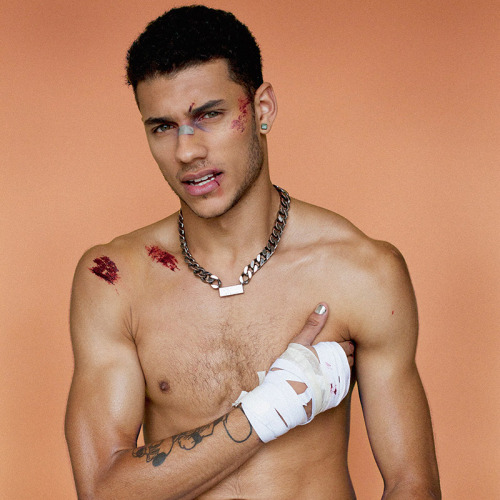 voulair:   Jordan Matheson for Wonderland Magazine Winter 2013 