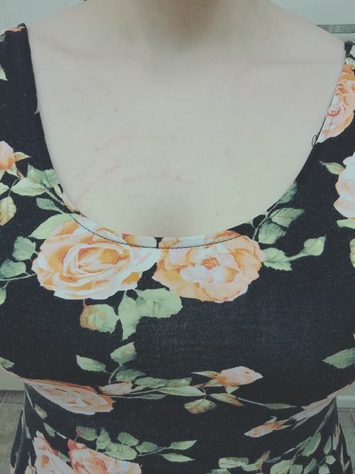 linnylace:  probably one of the best feelings in the world  That upskirt with the marks. Mmmmmm.