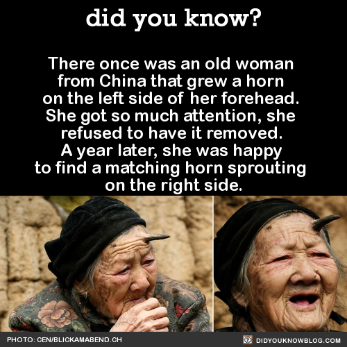 did-you-kno:    Happy October! Today is Older Peoples Day and it’s nearly Halloween, so I found this doubly appropriate.    Zhang Ruifang, who was 101 in these photos, was afflicted with cutaneous horns - which are growths made of keratin (the same