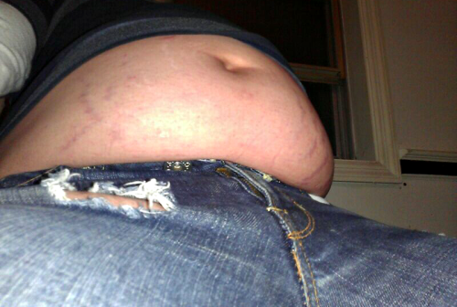 insatiableshadz: dang stretch marks are comin back :v eatin ~$20 worth of mcd’s fries isn’t gonna ma