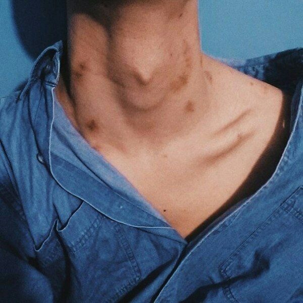 Where can you give hickeys