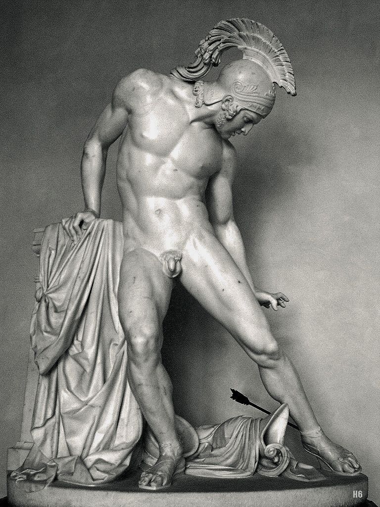 ganymedesrocks:  hadrian6:  Achilles Wounded. 1842. Innocenzo Fraccaroli. Italian