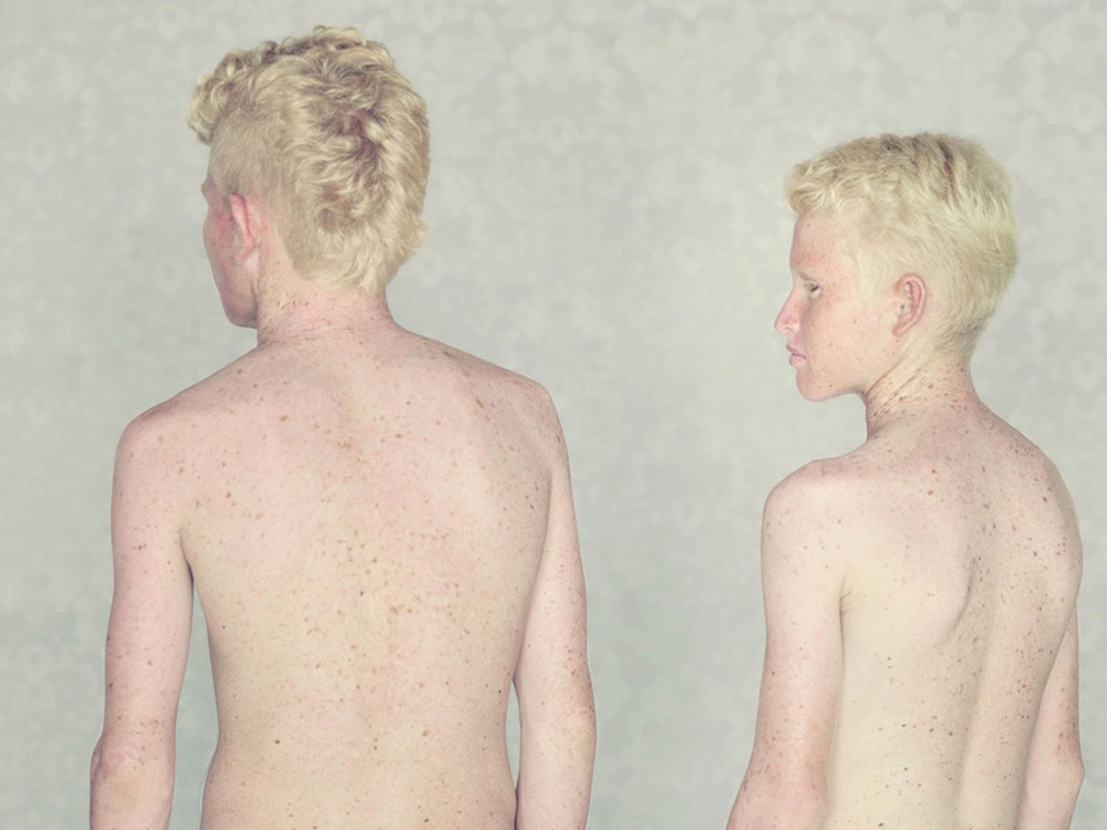 jareth-gates:  likeafieldmouse: Gustavo Lacerda - Albinos (2009-12) 