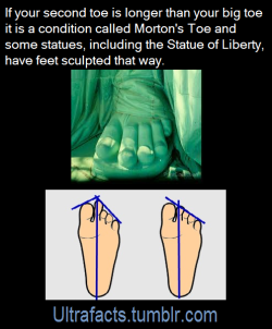 ultrafacts:Morton’s toe (or Morton’s foot, Greek foot, “Royal toe”, “LaMay toe”, “Sheppard’s toe”, Morton’s syndrome, long toe) is the condition of a shortened first metatarsal in relation to the second metatarsal. Lots of people