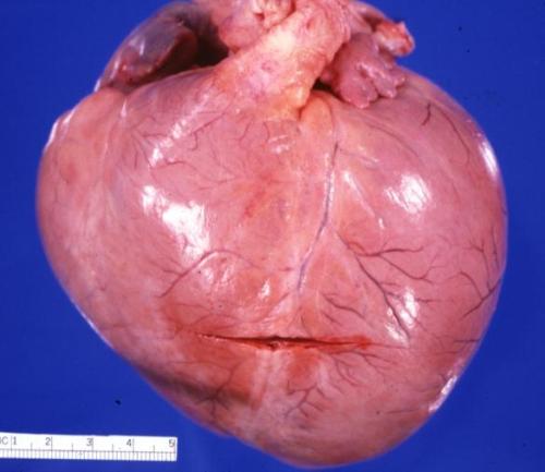 For Those Who Are Wondering. Do Giant Hearts Exist? And The Answer Is Yes. And Do Women Get Them? Yes,