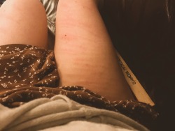 dressedincotton-deactivated2022:The aftermath of a light caning