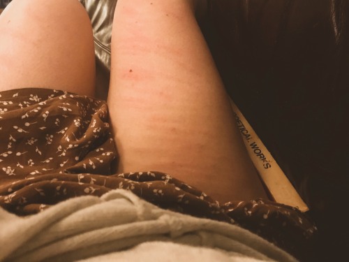 dressedincotton-deactivated2022:The aftermath of a light caning