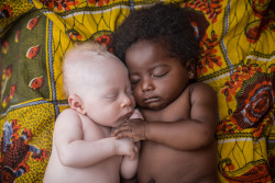 A newborn albino baby sleeps peacefully with