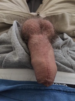 conqueredcocks:  conqueredcocks:  1,000 notes and this guy has agreed to get CIRCUMCISED. His penis taken apart and reworked to the American Standard 😏 Come out with a COCK  If everyone just kept on reblogging, well, you know what could happen 😉