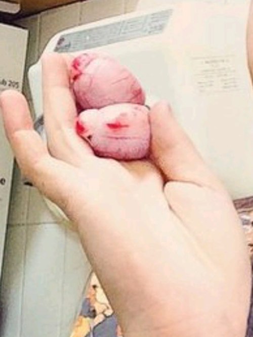 His former balls