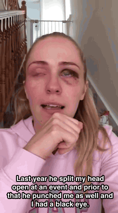 huffingtonpost:  WATCH: Woman’s Powerful Video Shows The Devastating Reality Of Domestic Violence