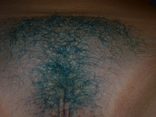 Blue pubes or Green pubes?