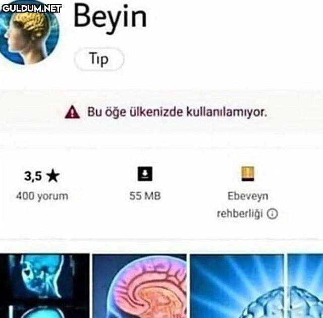 Вeyin Tip A Bu öğe...