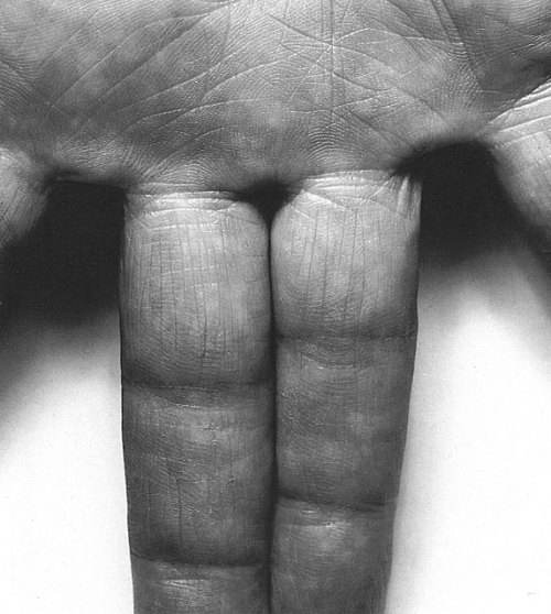 cavetocanvas: John Coplans, Self Portrait, Two Fingers (aka Hand, Spread), 1987