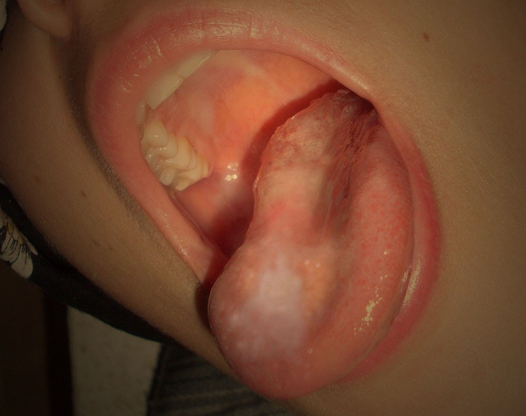 amateurfuckers:  britney1986editedversion:  Every time I go to the dentist he gets