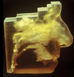 vuls:  Side view of acrylic biomodel of sinuses