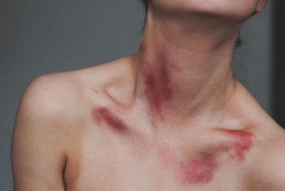melinschka:  ~ 