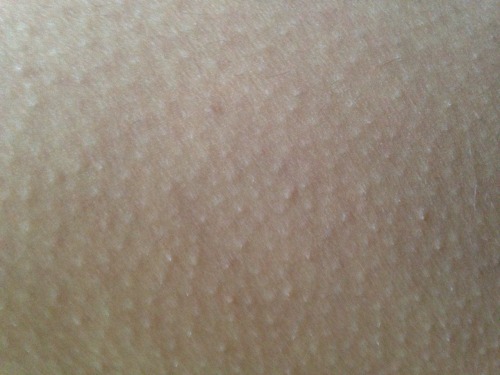 vampire-arcade:  Body comparative // goosebumps and raindrops on a window 