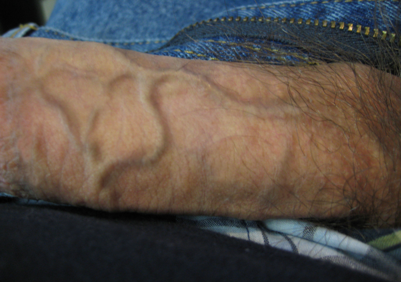 bitebienveinee:  Veiny cock detail 