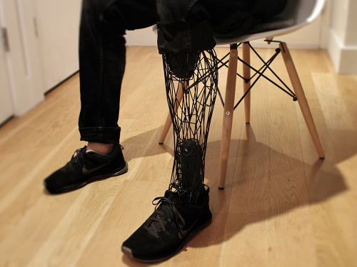 sculptores:William Root - Exo (3-D printed prosthetics)