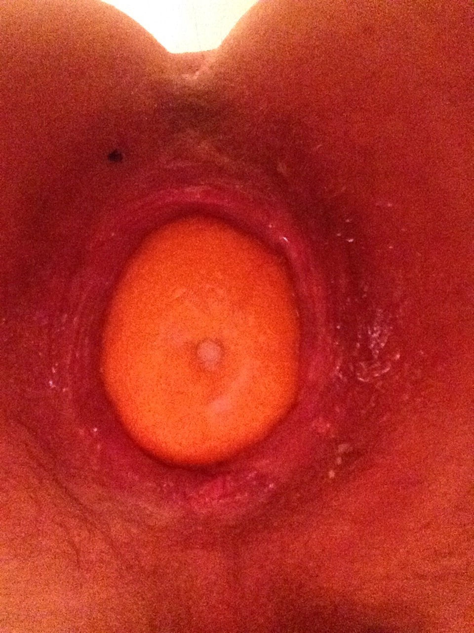 machineanddildofucked:  My ass swallowed an orange  a very good cunt stretchingFollow