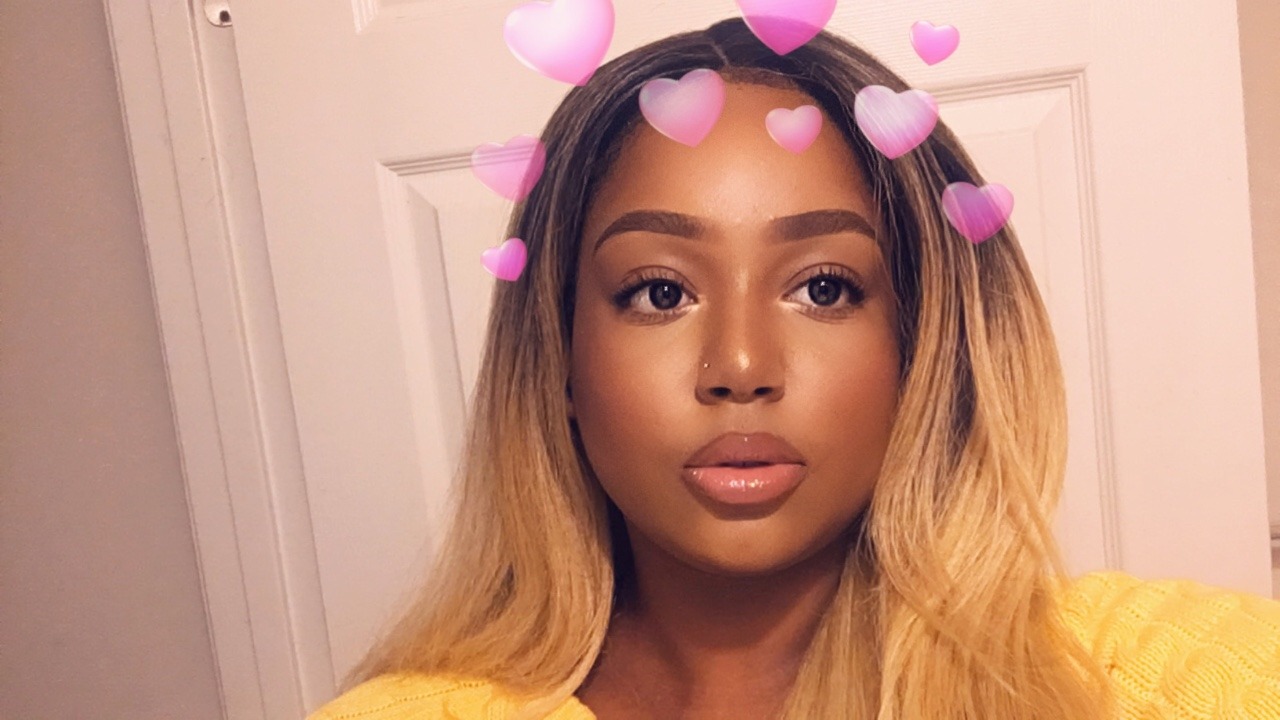 lucidnee:  lorrydii:  lucidnee:  hey  little chin dimple!!! you are so beautiful,