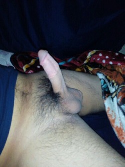 circumcisedperfection:  My mate was circumcised over 10 months ago. Cut half way back!! His circumcised cock is such an important improvement to what he had before. If you like it share it. If you want to see more comment. He loves all the people out