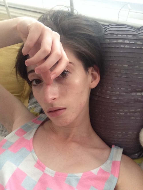 sodigress:trying to put sun on my face this summer [they/them thx]