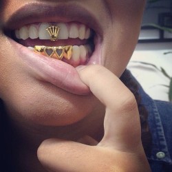 Phuckindope:  Anyone Lookin’ To Get Grillz? Check Out @Undergroundgrillz For The