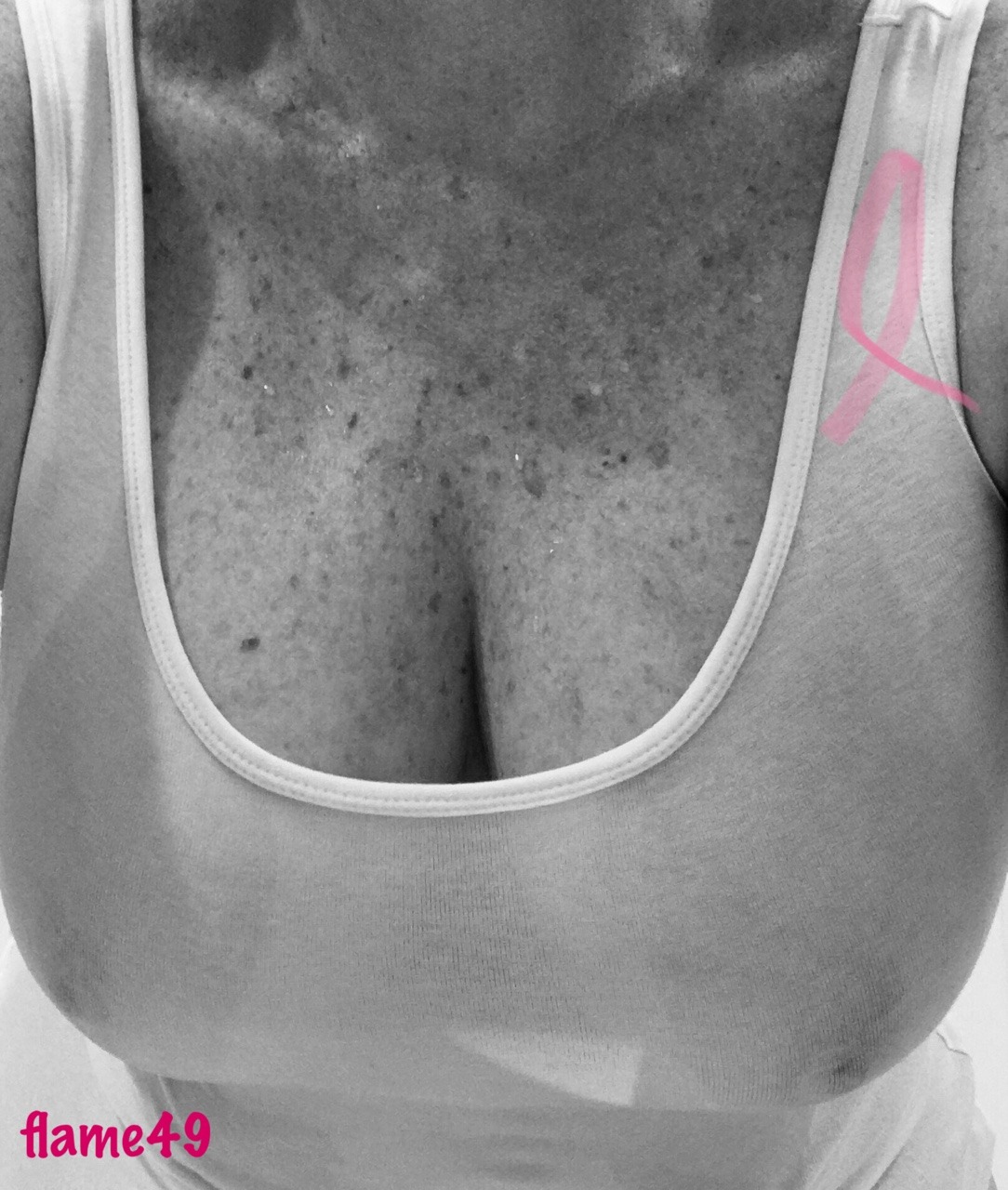 like-a-moth-to-a-flame49:  Breast Cancer Awareness Month … Schedule your mammogram