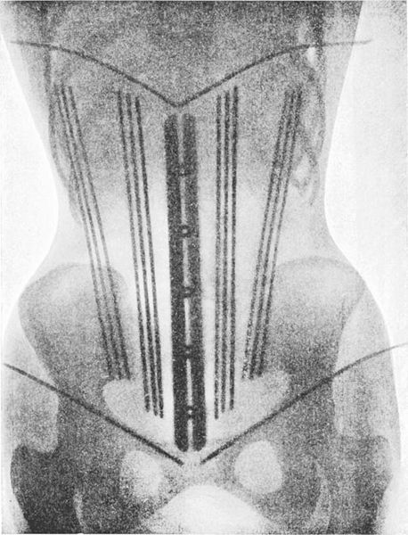 lucysskeleton:Ludovic O’Followell’s, X-Ray illustrations for Le Corset (1908)Source