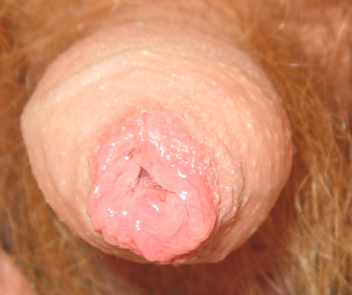 gallardocolour:  Close-up of my small cocks foreskin with some precum