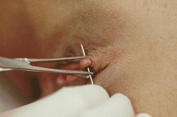 Piercing needle through her clit, now for the ring!