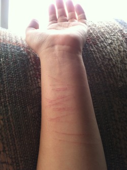 hisslutforlifeee:  Self harm. It’s what