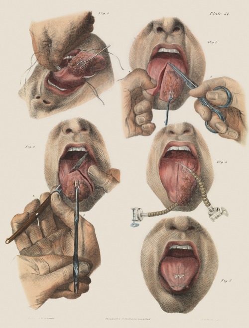 forensicimagination:“The greatest challenge in telling the story of surgery lies in its very nature,