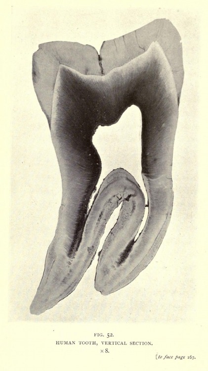 A selection of human photomicrographs captured by Arthur E Smith in 1904 using his early apparatus: 