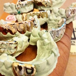 chigrillz-goldteeth:  Come out to 70 W. Madison 14th floor suite 1469 to get your custom grillz made.. By appointments only so call/text &amp; DM.. (312)925-5217 Shai  Http://www.chigrillz.com &amp; http://www.chi-grillz.com  #Goldteeth #Grillz #jewelry
