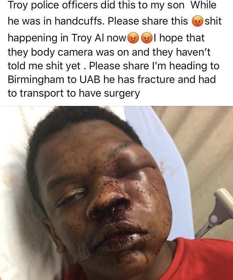 whyyoustabbedme:  17-year old Ulysses Wilkerson of Troy, Alabama was kicked, punched