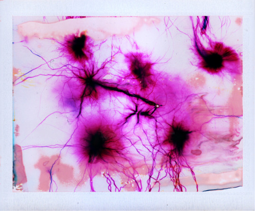 likeafieldmouse:  Phillip Stearns - Retinal Pigment Epithelium and Other Vision Technologi