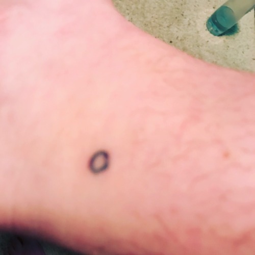 This was my first stick'n'poke. I did it back in December. It looks a little funny but I don’t think