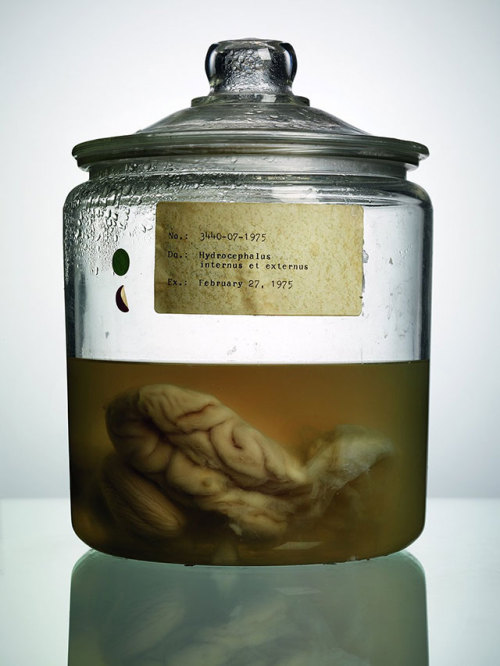 sixpenceee:  Malformed: Forgotten Brains of the Texas State Mental HospitalMalformed, from photographer Adam Voorhees and journalist Alex Hannaford, documents the strange collection of brains in jars taken from mental patients, and documents the unusual