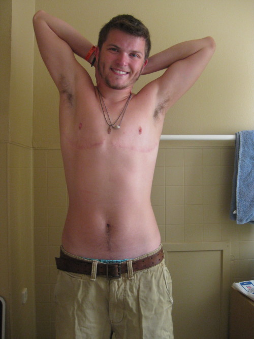 cameoamalthea:  iknowwhoholdstomorrow:  azryal00:  leaveyourdoubt:  askytheycannotbury:  Oh what a difference a year makes. one year post-op. one year three months on T. original post: this is what a man looks like.  the smile is the real difference