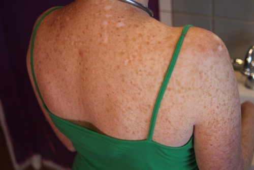 Here’s a shot of her sexy speckled shoulders for all the freckle freaks out there…