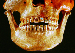 coolthingoftheday:  In ancient Mayan culture, it was not uncommon for individuals - mostly men - to decorate their teeth with jewels. Using gems including jade, amethyst, and turquoise, Mayans would adhere the stones to their teeth using natural resins