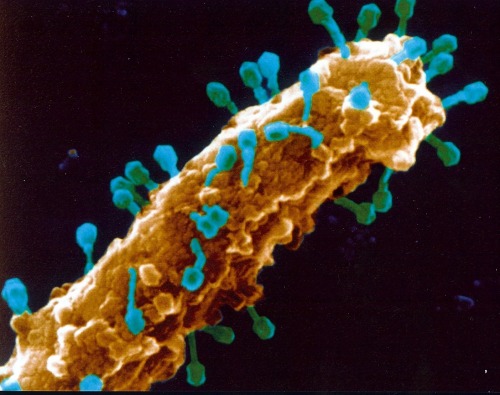 currrentbiology: T-bacteriophages chomping on e. coli [69000x magnification] Bacteria infected with