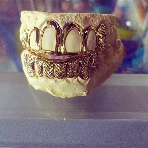 @stevenkleinstudio  #grillz #gold #grills #goldteeth #mouthfullofgold #yellowgold #whitegold #sincer