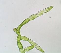 propaedeuticist:  protonemata&gt;plant&gt;sporangium: repeat - the delicate life of Physcomitrella patens